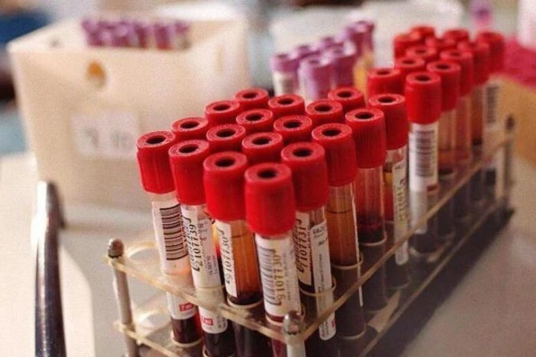 Un prelievo di sangue in futuro potrà prevedere l'efficacia della chemio