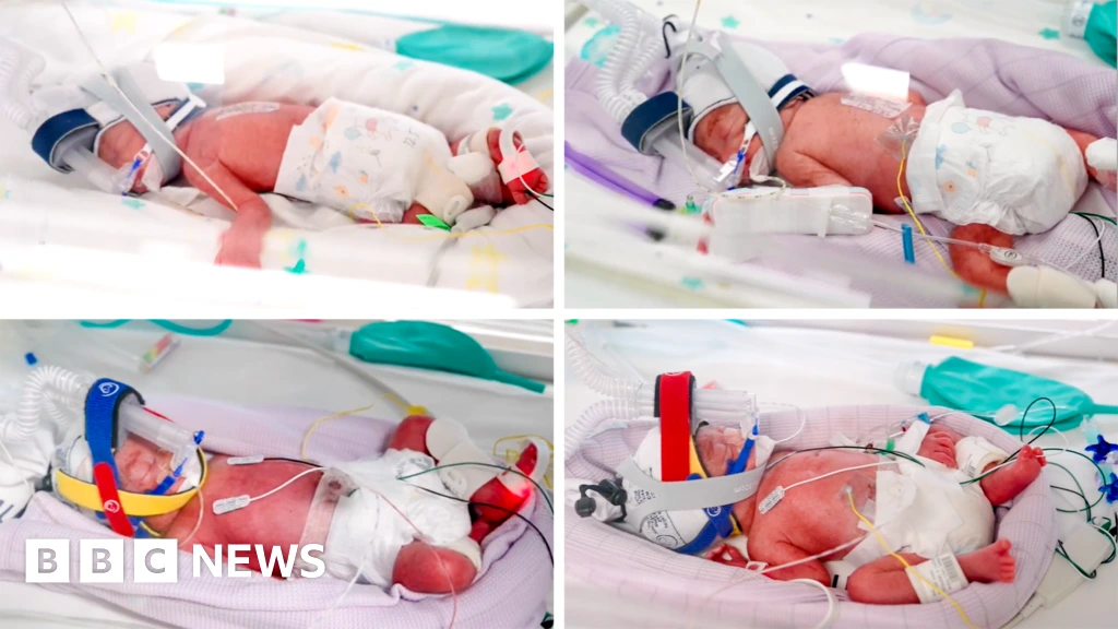 Rare identical quadruplets born in Australia