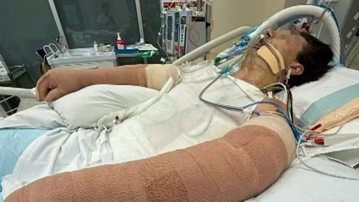 Zwei Wochen Koma, 75 Prozent Haut verbrannt: Ihm ist der Staubsaugerroboter explodiert!